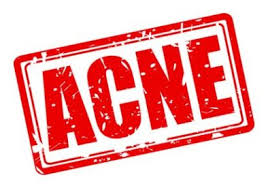 Education - Acne Specialist Presentation - 2 Hours